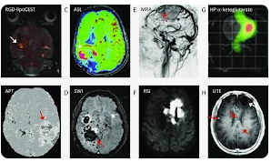 Click image for larger version

Name:	Emaratforums - Contrast mechanisms in MR imaging MRI.png
Views:	0
Size:	94.6 KB
ID:	99