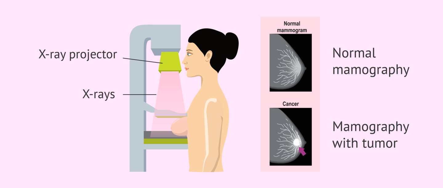 Click image for larger version

Name:	Emaratforums - mamography.png
Views:	0
Size:	115.5 KB
ID:	102